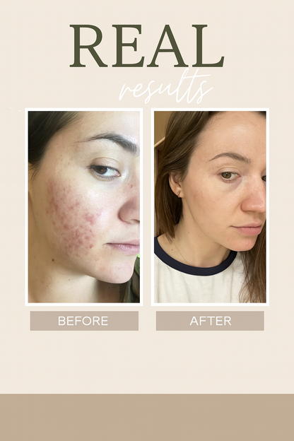 Glowvia  Repair Cream